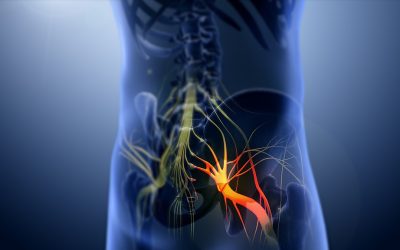 What is Sciatica and What is the Best Treatment?